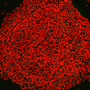 stem cell colonies
